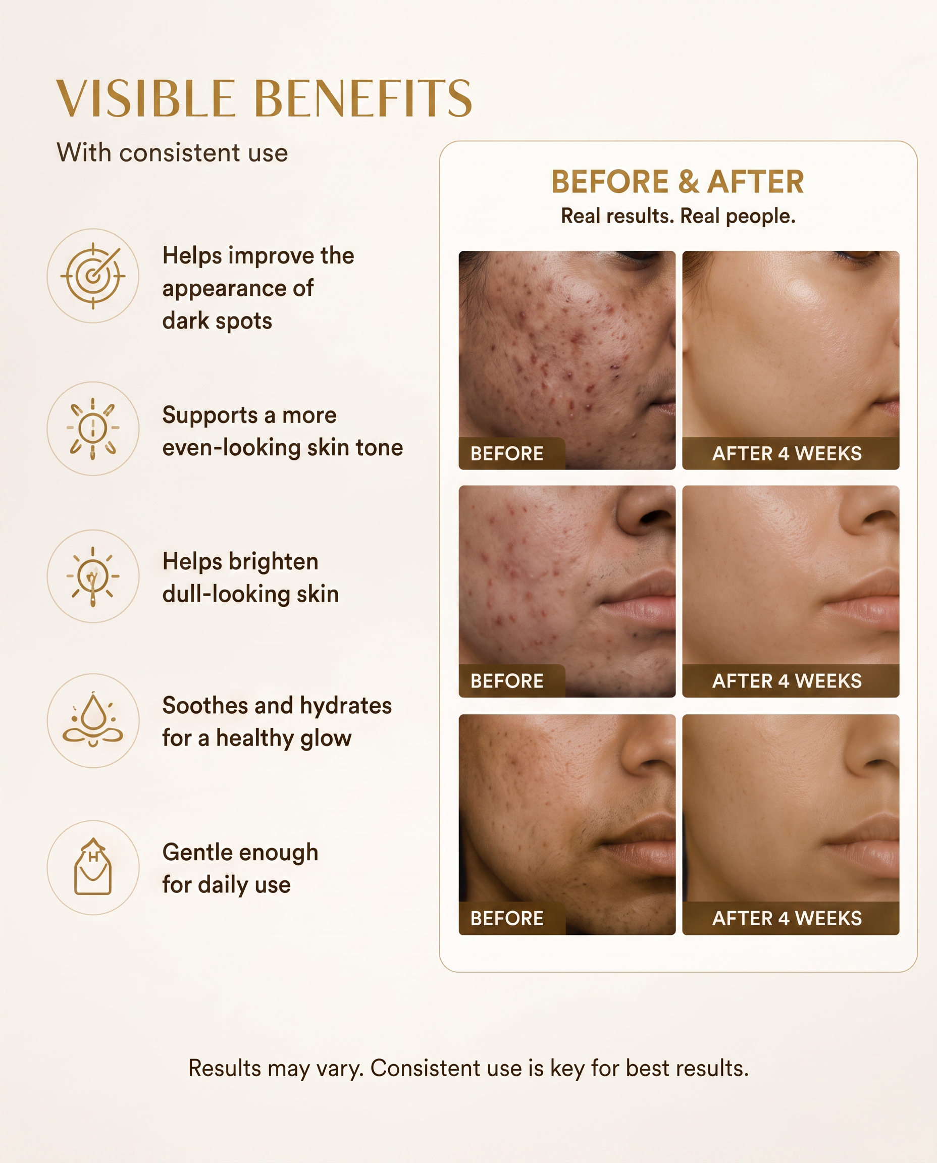 Dark Spot Serum for Sensitive Skin