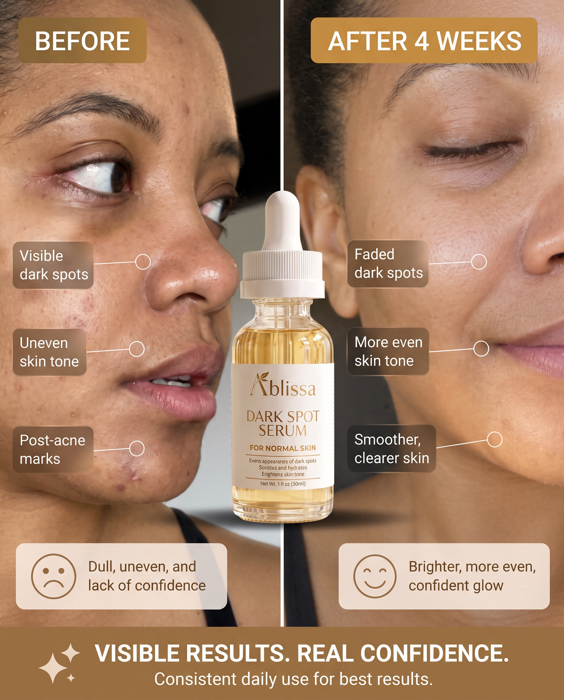 Dark Spot Serum for Normal Skin